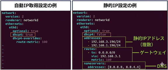 イーサネット設定の変更